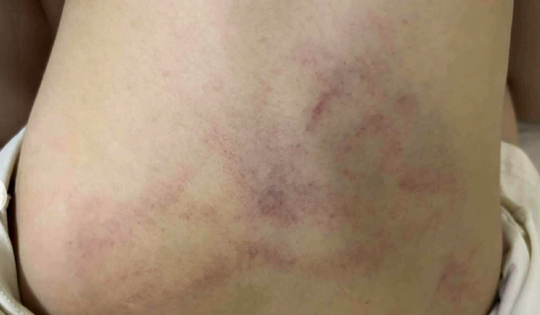 Bạo hành trẻ ở mầm non Gia Thụy: Phụ huynh ám ảnh, chuyên gia nói gì?