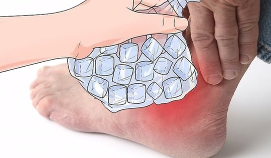 Cách giảm đau nhanh cơn gout cấp