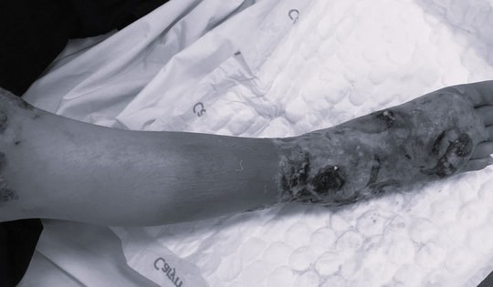 Những cách chữa bệnh xương khớp khiến bác sĩ phải 'lắc đầu' ngao ngán