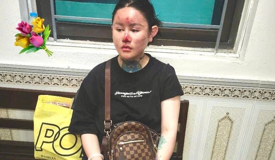 Cú trượt dài của 'Ngân Baby', một hiện tượng mạng tai tiếng