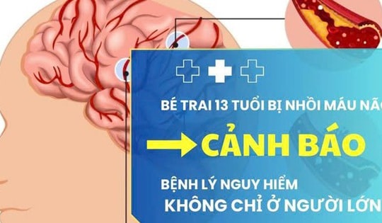 Bé trai 13 tuổi bị nhồi máu não: Cảnh báo bệnh lý nguy hiểm không chỉ ở người lớn