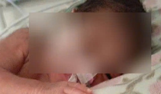 Trẻ sơ sinh nặng 0,7 kg bị hội chứng suy hô hấp cấp nặng được cứu sống ngoạn mục