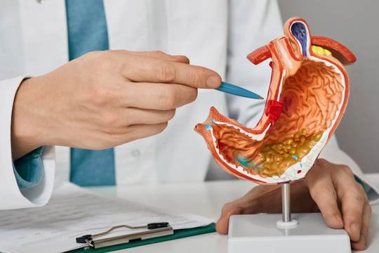 Viêm loét dạ dày – Mối lo âm ỉ nơi văn phòng hiện đại