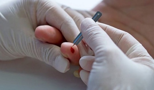 Có nên chích đầu ngón tay khi đột quỵ?