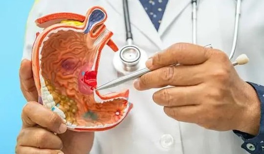 Nên và không nên ăn gì khi bị loét dạ dày?