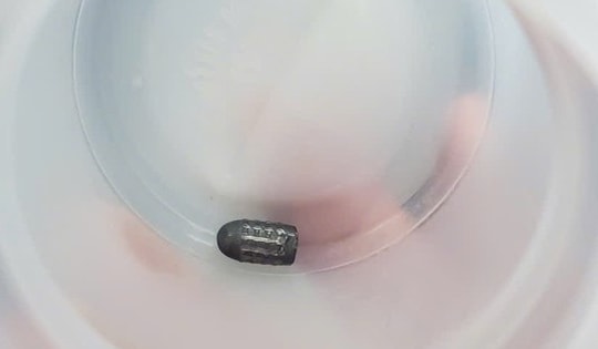 'Đạn lạc' găm vào đầu khi đang làm vườn, người phụ nữ may mắn thoát chết