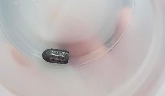 Đã tìm được đối tượng dùng súng hơi bắn chim khiến đạn lạc trúng đầu người phụ nữ đang làm vườn