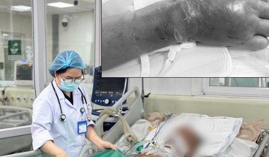 Bị tai nạn lao động nhưng không tiêm phòng uốn ván, bệnh nhân rơi vào nguy kịch