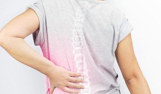 Cách bổ sung canxi phòng ngừa loãng xương cho phụ nữ mãn kinh