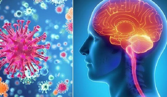 Bị bệnh truyền nhiễm cấp tính não mô cầu xâm lấn, nguy cơ tử vong cao