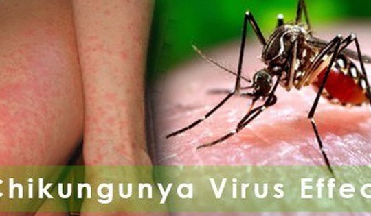 Bộ Y tế: Tăng cường giám sát dịch Chikungunya ngay tại cửa khẩu, cơ sở y tế, cộng đồng để phát hiện sớm ca bệnh
