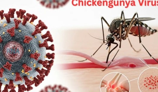 Muỗi đốt truyền bệnh Chikungunya lưu hành tại nhiều địa phương, Bộ Y tế nói gì về nguy cơ dịch bệnh này?