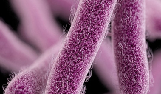 Pháp thu hồi phô mai mềm sau 2 ca tử vong nghi nhiễm khuẩn listeria