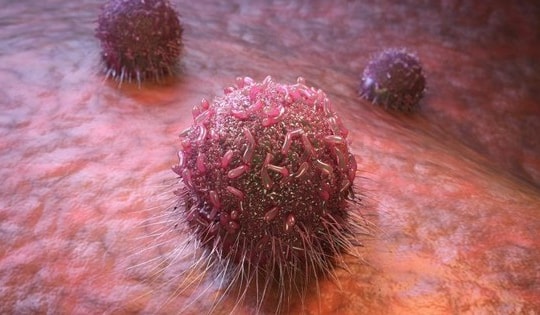 Công nghệ mới giúp đưa thuốc nhắm chính xác vào tế bào ung thư