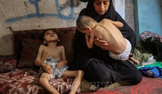 Gần 13.000 trẻ em Gaza phải điều trị suy dinh dưỡng khi viện trợ vẫn nhỏ giọt