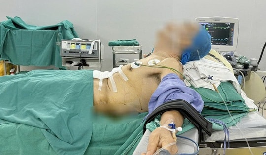 Bệnh nhân 'nửa nằm, nửa ngồi' trong ca phẫu thuật ung thư dạ dày