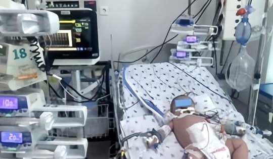 Sốt xuất huyết ở TPHCM tăng mạnh, nhiều trẻ nguy kịch do biến chứng nặng