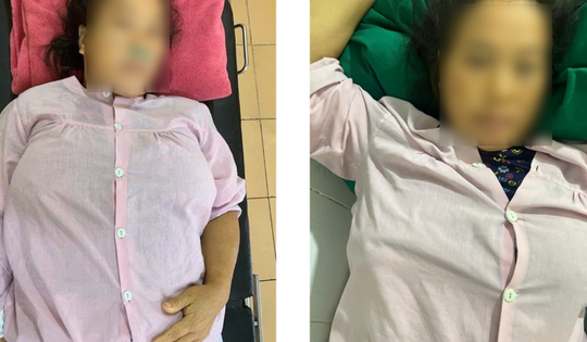 Cảnh báo từ câu chuyện thai phụ người Mông phá thai bằng thuốc không rõ nguồn gốc