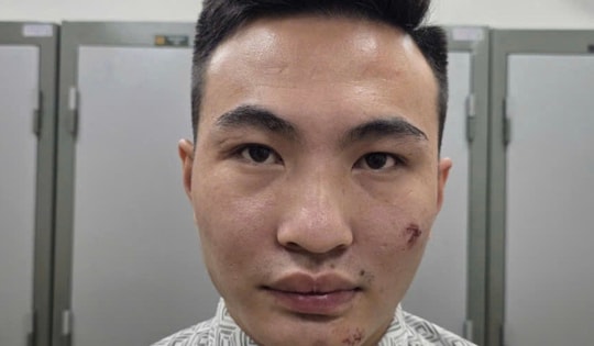 Tạm giữ thanh niên lái xe máy tông cán bộ Công an bảo vệ A80