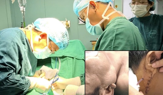 Hàm sưng to, cụ ông tái phát u tuyến nước bọt sau gần 10 năm