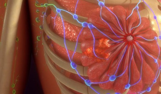 Thử nghiệm xóa sổ 'tế bào ngủ' gây tái phát ung thư vú