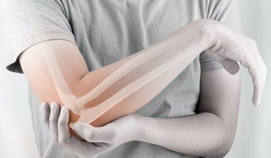 Loãng xương sớm - Dùng thuốc và phòng ngừa như thế nào?