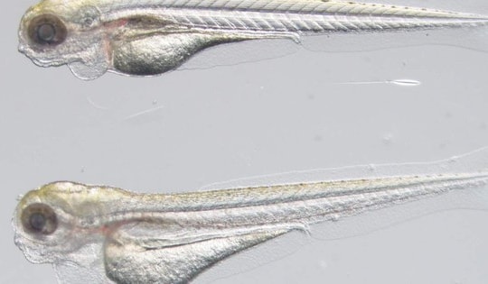 Sử dụng phôi cá ngựa vằn để tìm ra thuốc điều trị bệnh rối loạn bạch huyết