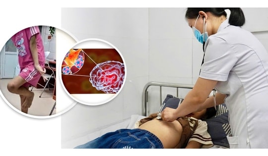 Cứu sống bé gái 12 tuổi bị viêm não tự miễn