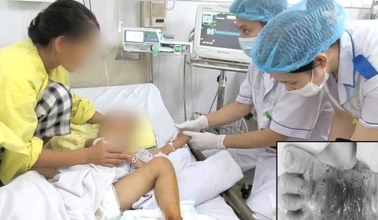 Bà đắp thuốc nam cho cháu bị mèo cắn, cả bàn chân hoại tử