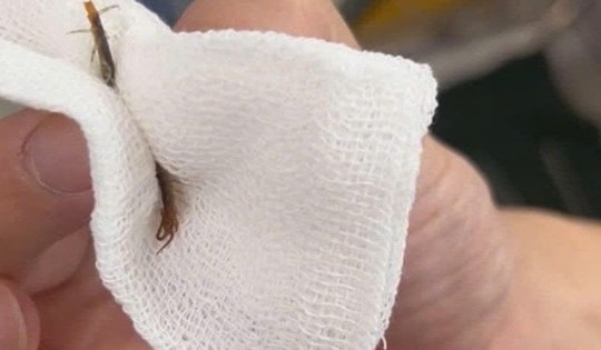 Ngủ ở công trường, người đàn ông bất ngờ bị rết chui vào tai