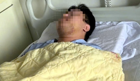 Bị cho là 'nhìn đểu', nam sinh viên phải nhập viện trong tình trạng gãy xương hàm