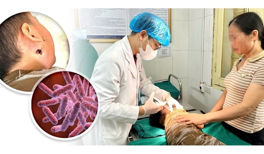 Cứu sống trẻ mắc bệnh Whitmore nguy hiểm