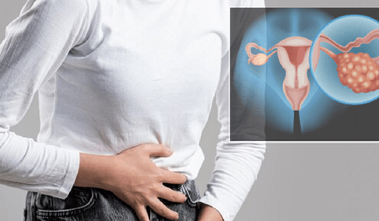 Có thể phát hiện sớm ung thư buồng trứng không?