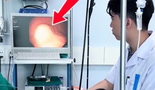 Đi khám vì ho, người đàn ông phát hiện u mô đệm dạ dày nguy hiểm