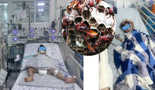 Chọc ong vò vẽ, một trẻ tử vong, một trẻ nguy kịch