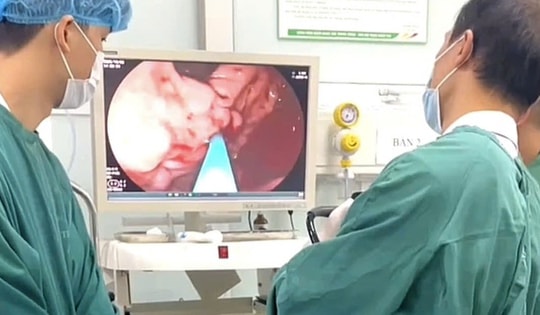 Nghĩ đau bụng bình thường, người đàn ông vào viện đã vỡ tĩnh mạch, máu phun thành tia trong dạ dày