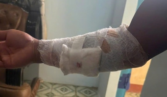 Truy tìm con cá sấu cắn nam thanh niên ở Khánh Hòa