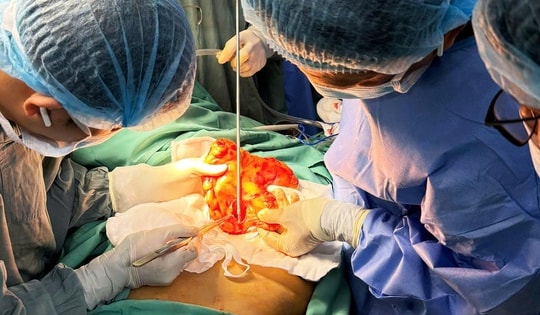 Việt kiều Mỹ 73 tuổi lựa chọn về Việt Nam phẫu thuật khối u đại tràng ác tính