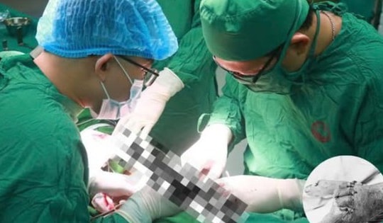 Bác sĩ cứu sống bàn tay bị vỡ nát cho bệnh nhân sau tai nạn giao thông