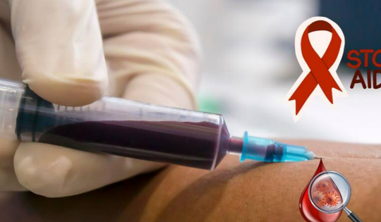Tầm quan trọng của các loại xét nghiệm HIV trong kiểm soát và quản lý bệnh
