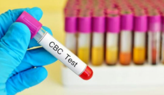 Những chỉ số máu quan trọng giúp quản lý HIV hiệu quả