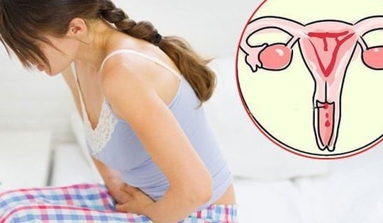 Ung thư cổ tử cung: Phòng bệnh từ hôm nay để bảo vệ ngày mai