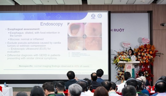 Việt Nam đón đầu các kỹ thuật mới trong điều trị nhu động thần kinh ruột