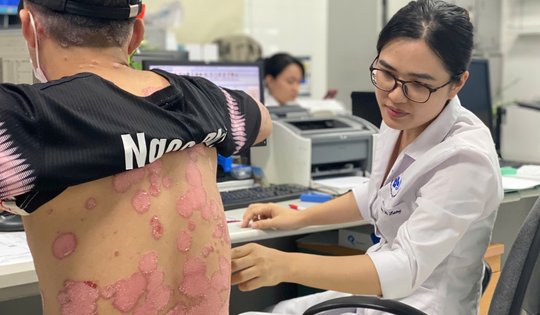 Cách ngăn chặn 'hiệu ứng Domino' ở bệnh nhân vảy nến