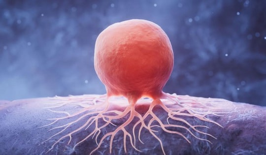 Giảm chất béo có thể 'bỏ đói' tế bào ung thư vú