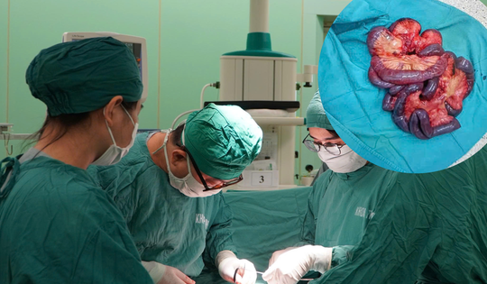 Nam bệnh nhân hoại tử gần 5m ruột non do tắc động mạch hiếm gặp