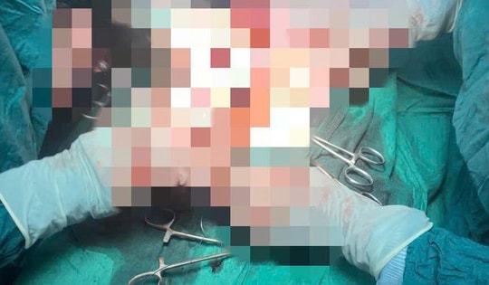 Cứu sống bệnh nhân chửa ngòai tử cung vỡ tại Trung tâm Y tế Bạch Long Vĩ