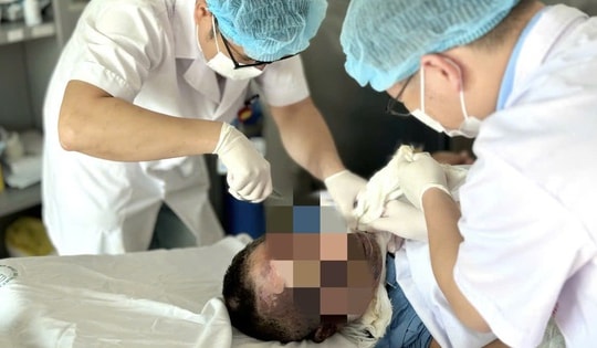 Giữ thang cho hàng xóm sửa điện ở chuồng gà, người đàn ông suýt mất mạng