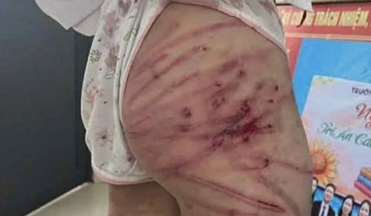 Hành vi bạo hành trẻ em sẽ bị xử lý như thế nào?