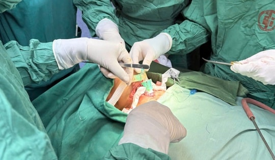 Kích hoạt báo động đỏ toàn viện cứu sống bệnh nhân chấn thương phức tạp vùng cổ